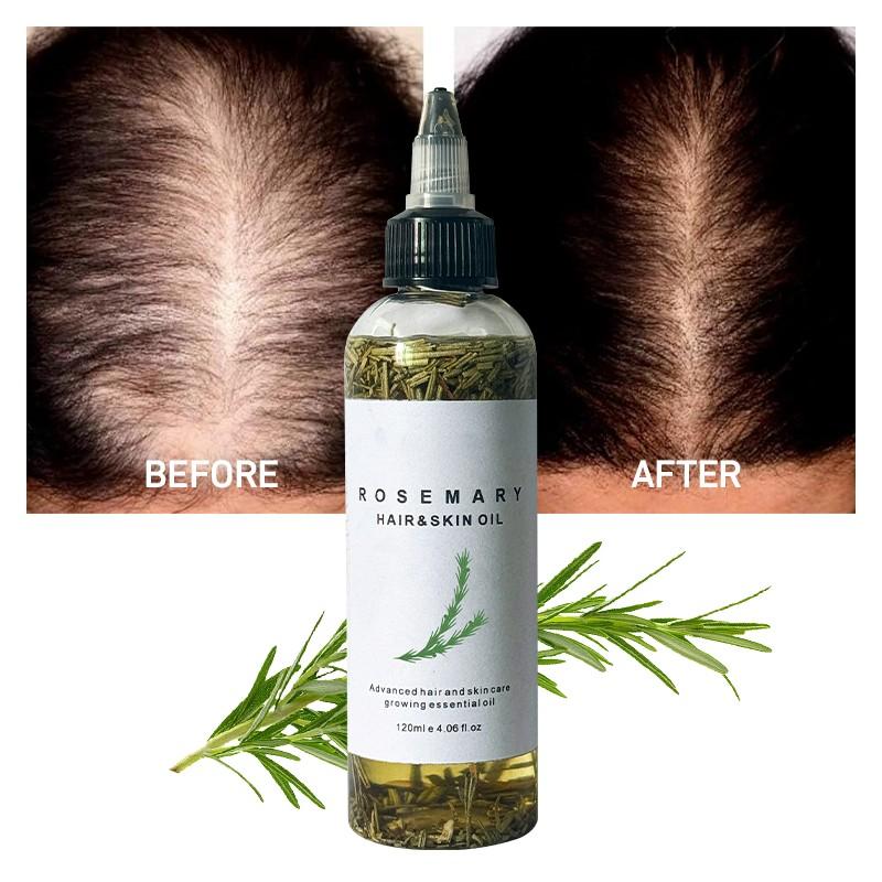 LANYAN 120ML Scalp Stimulating Hair Growth Oil, Light Mint & Peppermint Blend, Promotes Fuller Thicker Hair, Supports Hair Loss Repair