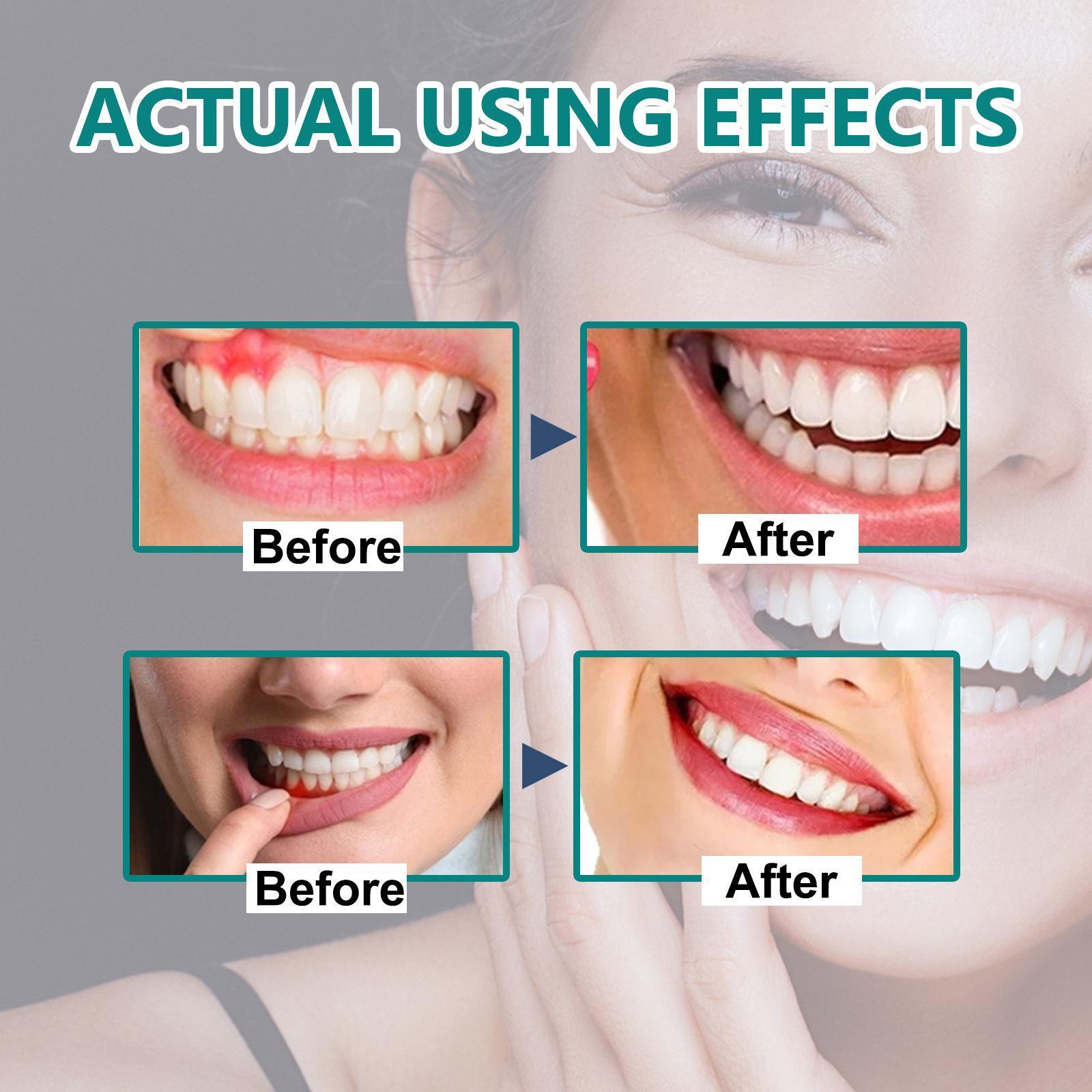 Rapid Repair Gums Serum Effectively Relieve Tooth Allergy Dental Caries Tooth Cleaning Toothpaste Relieve Tooth Damage Drops