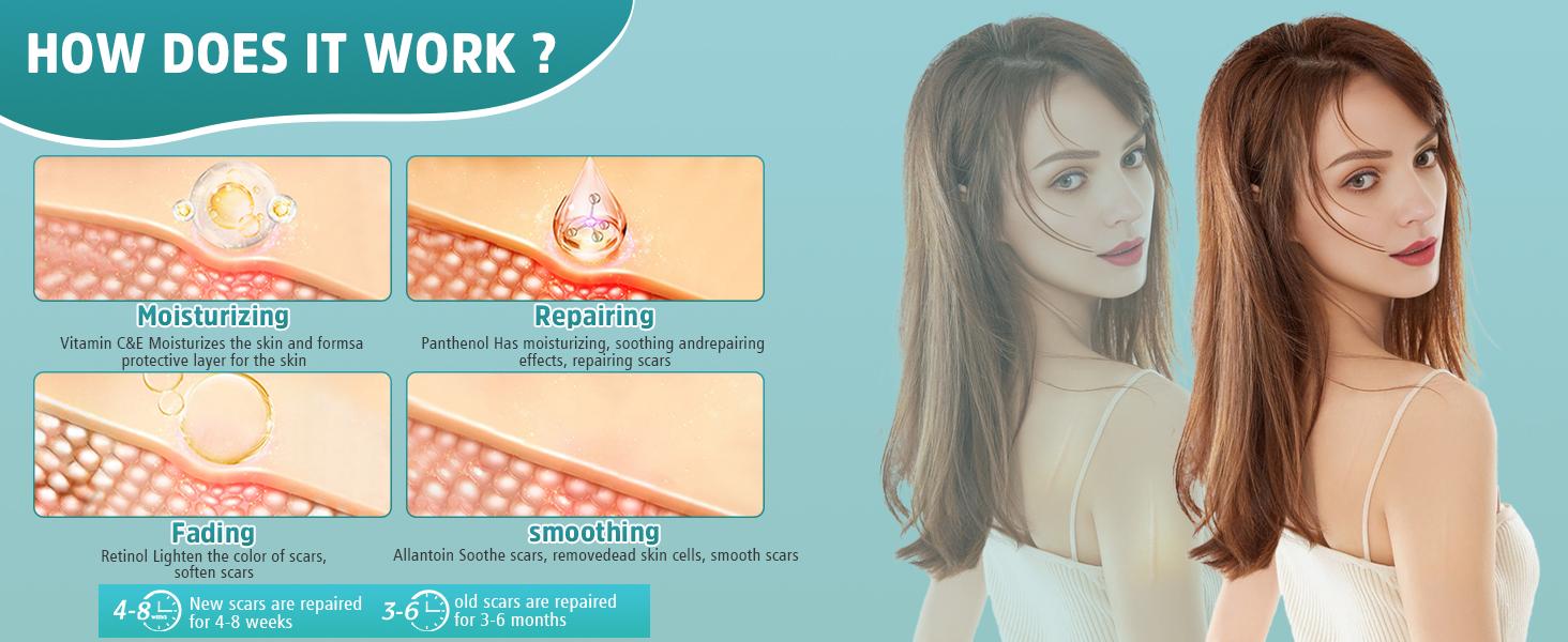 Scar Removal Gel Advanced Silicone Cream for Old New Scars Surgery Stretch Marks 1.7oz Scar Removal Gel Advanced Silicone Cream for Old New Scars Surgery Stretch Marks 1.7oz