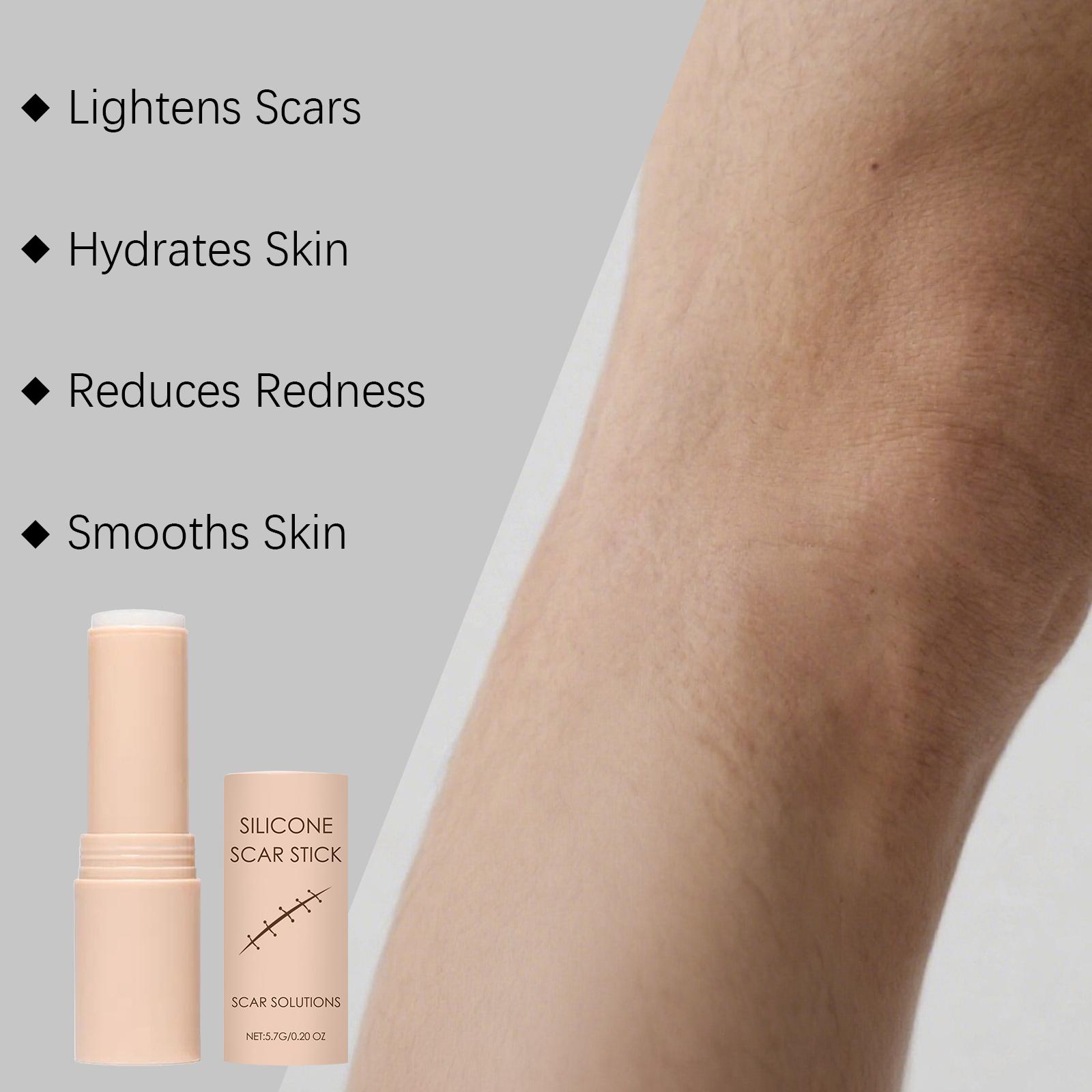 Skin Scar Moisturizing Care Stick, Nourishing Facial Body Skin Scar Appearance Smooth Soft Daily Care Cream, Essential Skincare Routine