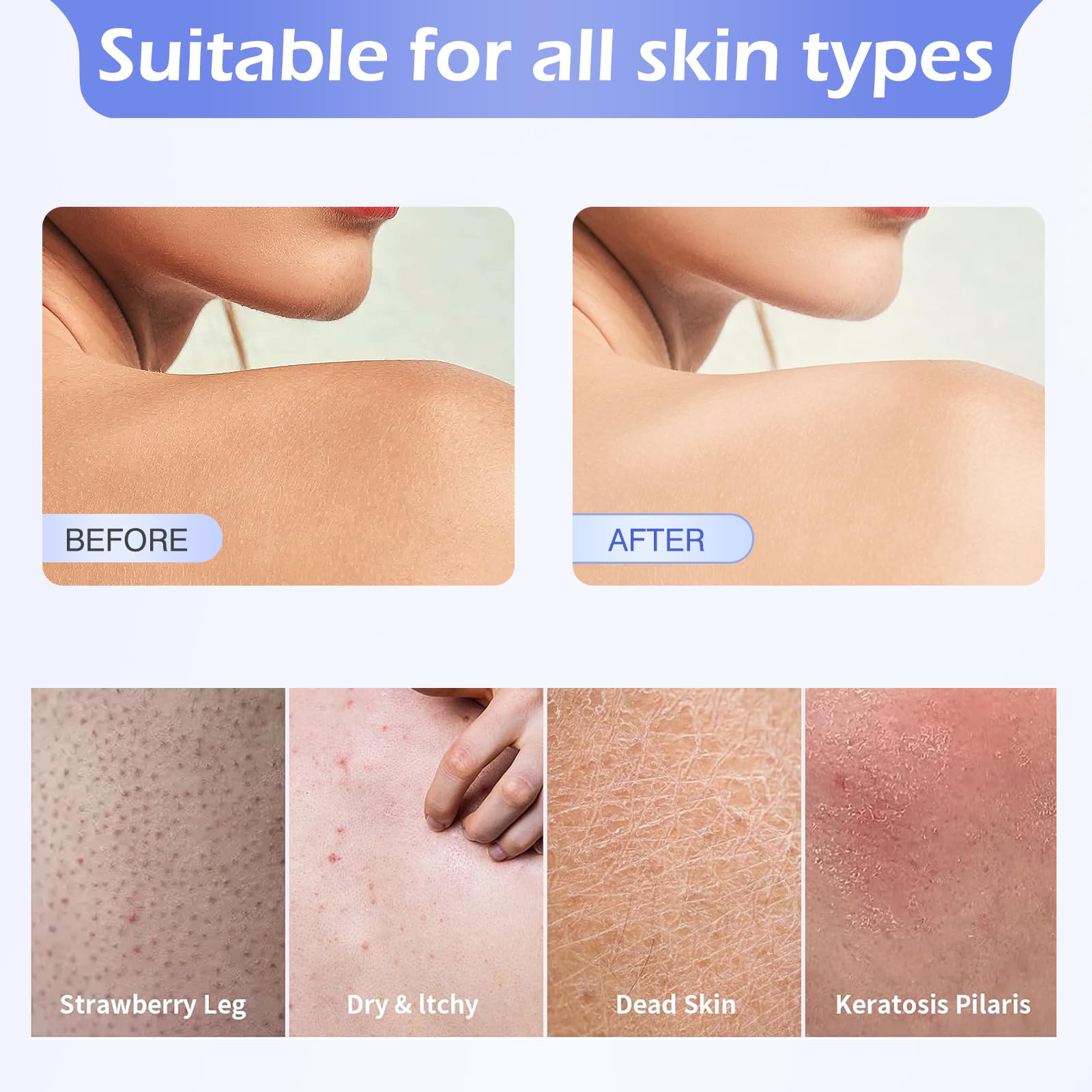 6 Counts Deep-Action Exfoliating Body Sponges – Heavy-Duty Bath Tools for Thorough Cleansing and Massage