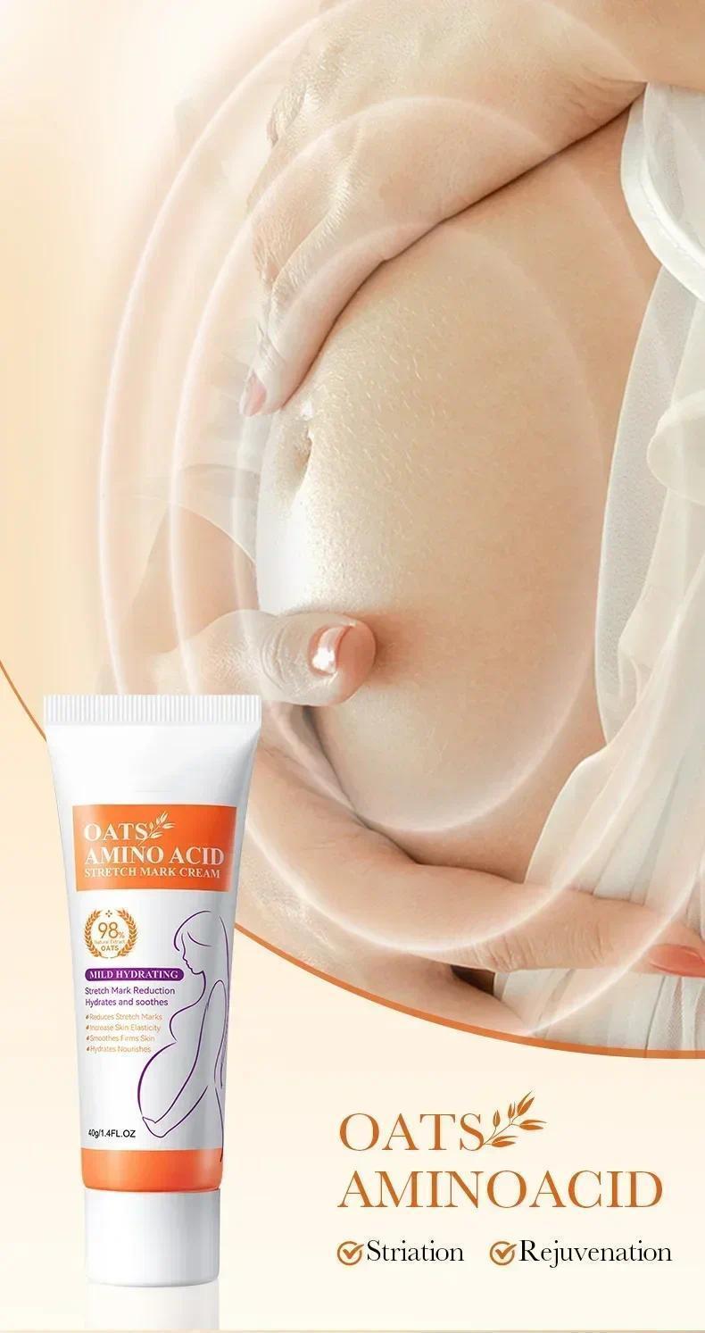 HOT SALE Stretch Marks Permanent Removal Eliminate Body Belly Stretch Marks Swelling Marks Remove Skin Cracks Repair Firming Car