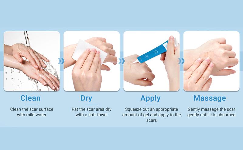 ANXINKANG Silicone Scar Gel, reduces the appearance of new and old scars from burns, stretch marks, surgery, trauma, keloids, etc., 0.70 oz (20g) ANXINKANG Silicone Scar Gel, reduces the appearance of new and old scars from burns, stretch marks, surgery, trauma, keloids, etc., 0.70 oz (20g)