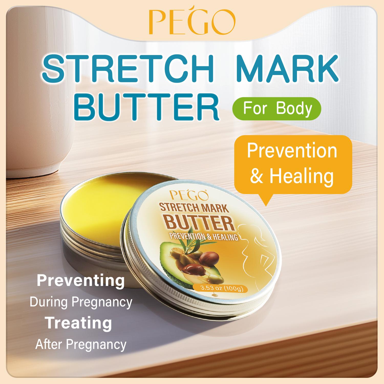 PEGO Stretch Mark Butter, Belly Moisturizer, Pregnant & Breastfeeding - Prevents & Heals Stretch Marks - Formula Enriched with Shea Butter & Vitamin E, 3.53 oz