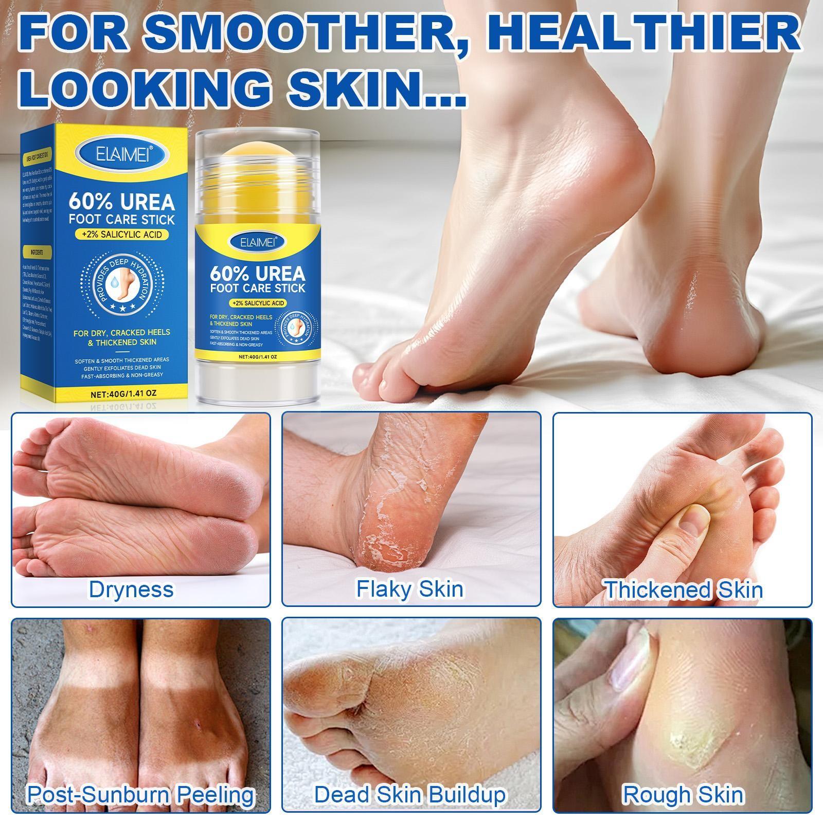 ELAIMEI Urea Care Stick, Hand and Foot Cream, Anti-Cracking Foot Cream, Moisturizing, Anti-Cracking, Softening and Nourishing Cream, suitable for dry, cracked feet, removes dead skin, and moisturizes dry skin