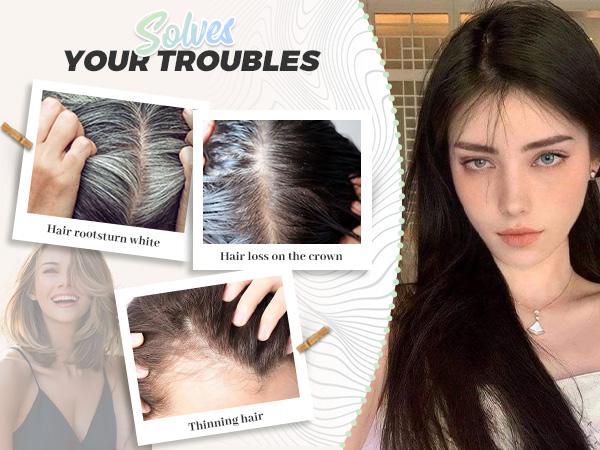 Hair Toppers for Women,Top Hairpieces 100% Remy Human Hair no Bangs,120% Density Swiss Base Clip In Topper 7x10CM 10inch Hair Toppers for Women Real Human Hair,Remy Human with Thinning Upgrade Middle Part Clip in Topper Hair Pieces for Women Daily