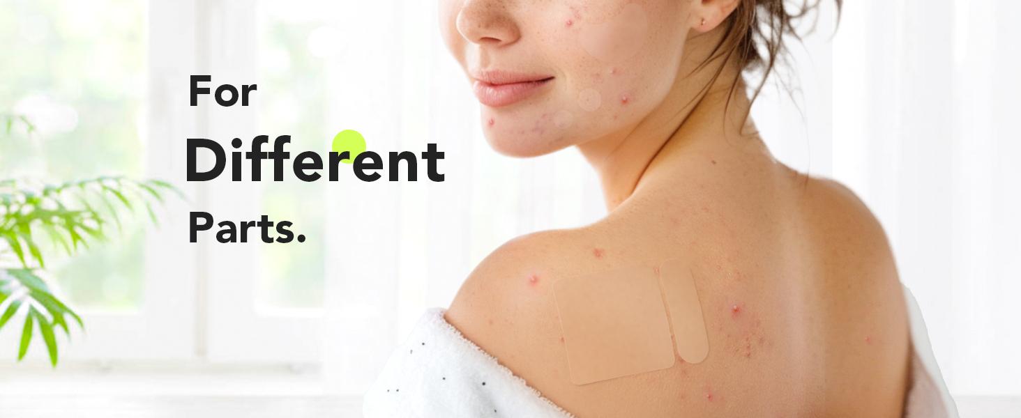 LitBear Skincare Large Pimple Patches 7 Sizes 306 Patches, Acne Spot Treatment XL Hydrocolloid Bandages for Full Face, Forehead,Back and Body Skincare