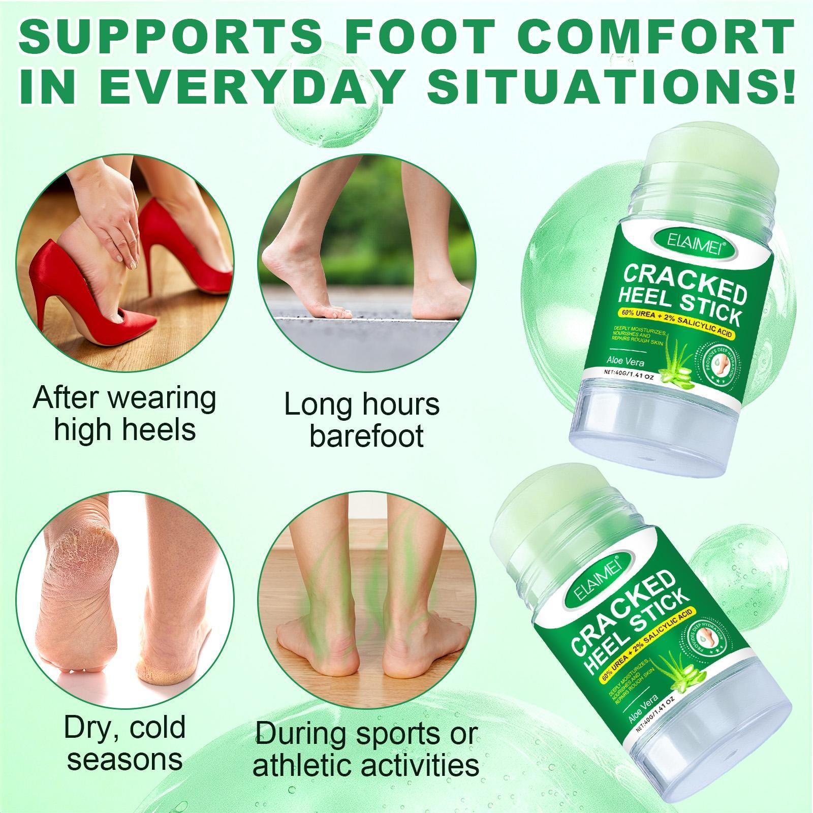 ELAIMEI Aloe Vera Skin Care Stick, containing ingredients such as urea and salicylic acid, softens rough skin, quickly moisturizes dry areas, soothes dryness, and provides long-lasting hydration.