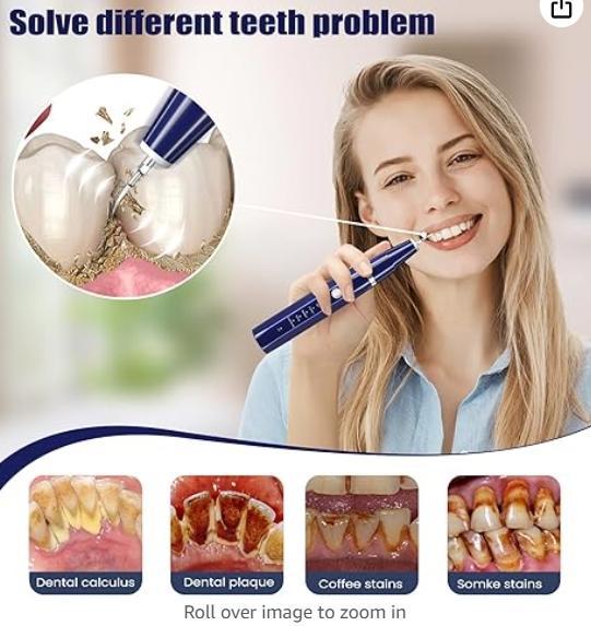 Stop struggling with food stuck in teeth! This sonic cleaner removes plaque in 30 seconds! From yellow stains to sparkling white! Cleansing Oral Removable Multicolor Kit Water Proof Jyq-01-Prilotte Store01