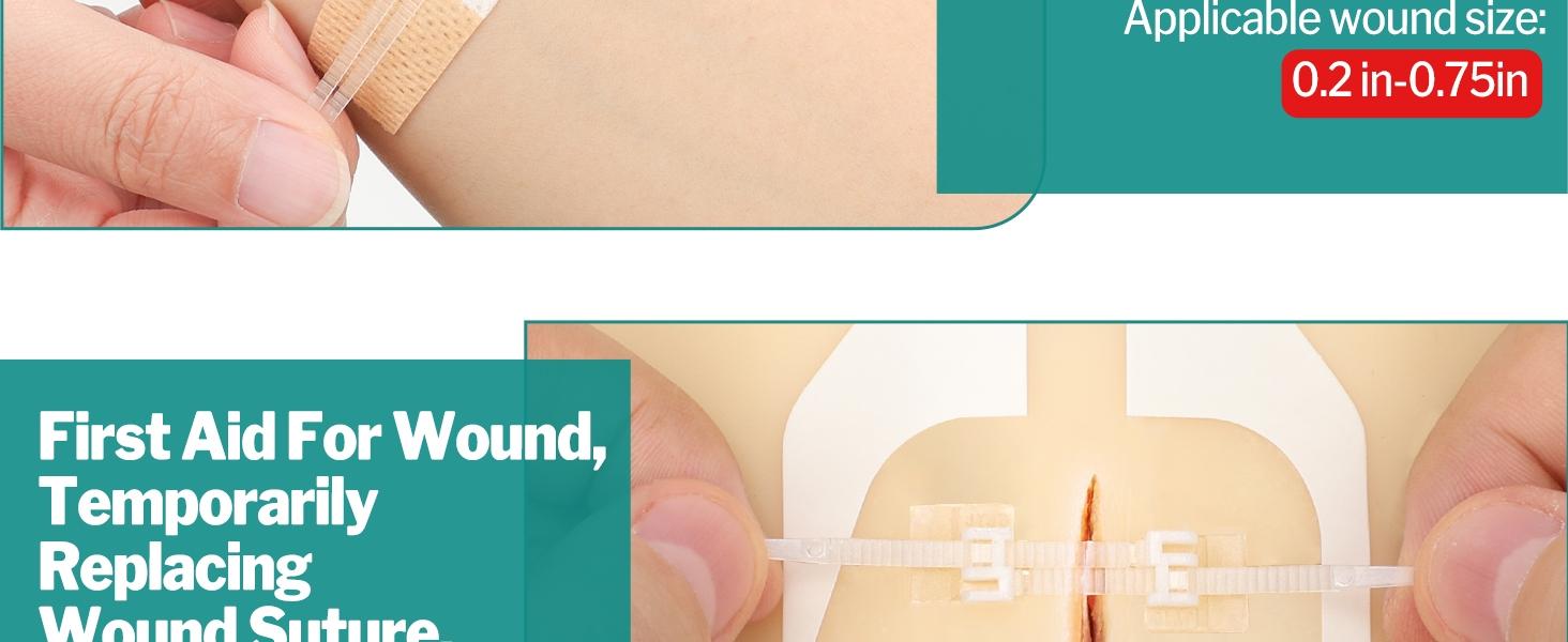 Sanke Rescue 14/28 Pack Wound Closure Strips Zipper Bandages Emergency Laceration Closure Kit Repair Wounds Closures Device