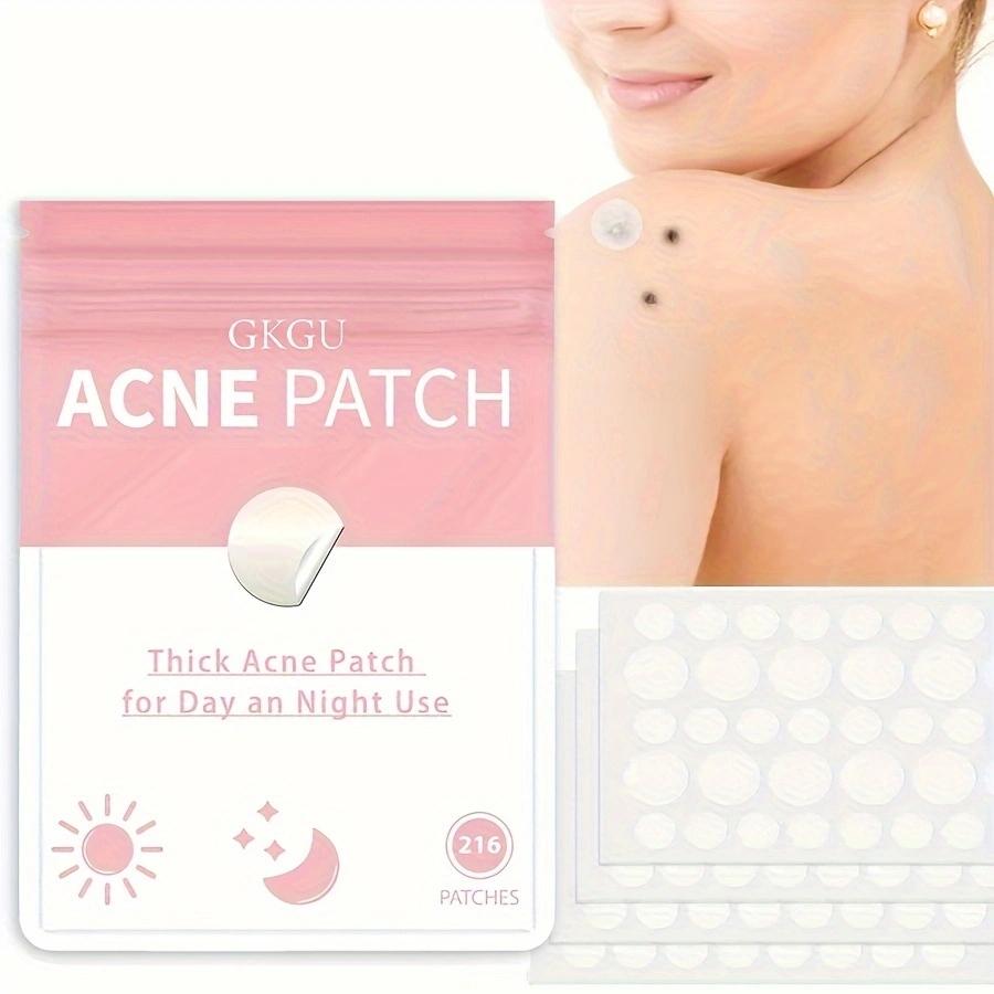 216 pcs acne patch, covering acne and blemishes, covering blemish spots, light beige spot acne patch, and concealer the daytime face, Acne Pimple Patch, Blemish Patches