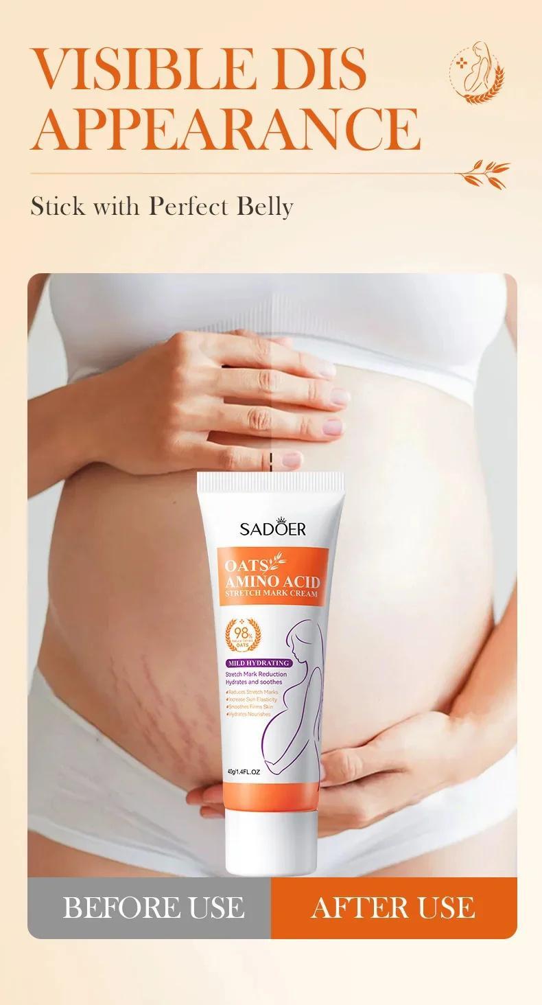 Stretch Marks Permanent Removal Cream Eliminate Body Belly Stretch Marks Swelling Marks Remove Skin Cracks Repair Firming Care
