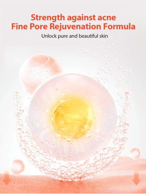 LOVILDS™ Acne Scar Cream