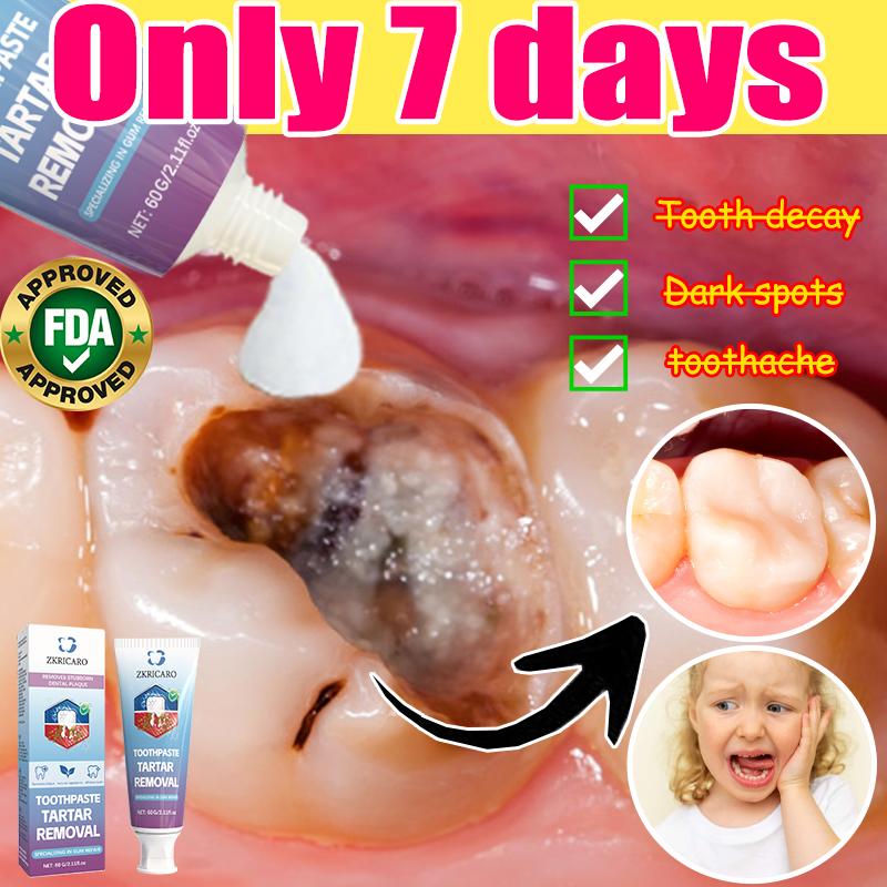 ZKRICARO Cavity Killer: FDA approved to remove plaque, repair cavities ...