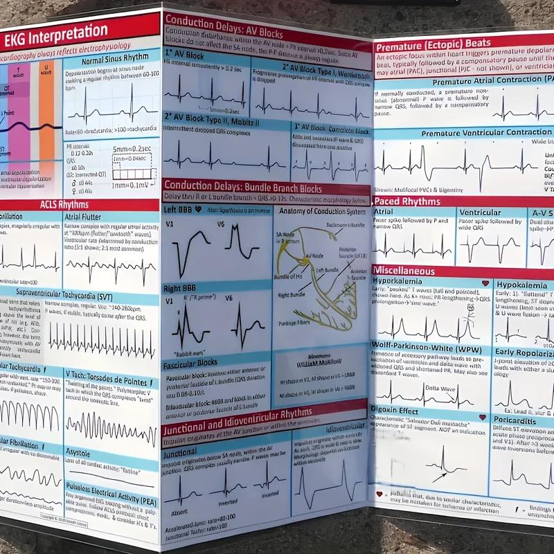 1/2/4-Piece ECG Pocket Guide, Double-Sided ECG Rhythm Interpretation Reference Card, Suitable For Nurses And Emergency Medicine Students, Portable Memo Card For Quick Learning Of Clinical Practice, Excellent Learning Card For ECG Interpretation
