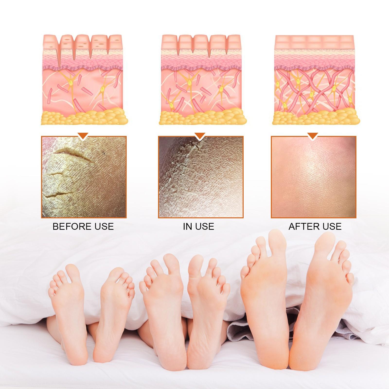 Exfoliating Care Spray Set of 2, Deep Cleansing Dead Skin Remover, Brightening Softening Skin Spray, Skincare Essentials