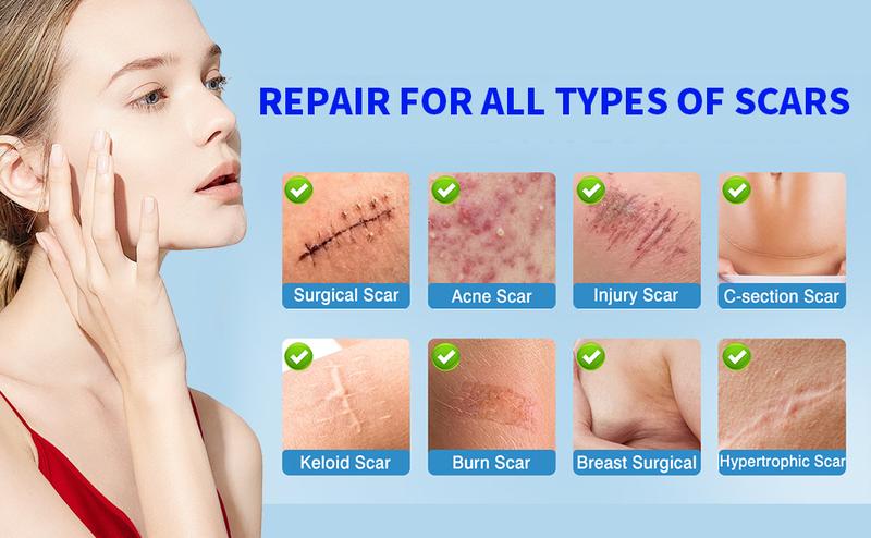 ANXINKANG Silicone Scar Gel, reduces the appearance of new and old scars from burns, stretch marks, surgery, trauma, keloids, etc., 0.70 oz (20g)