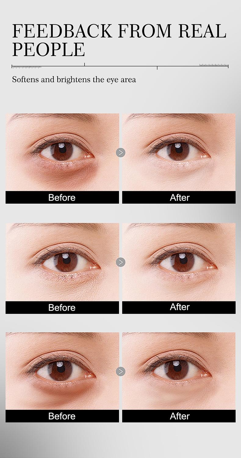 Press Massage Firming Gentle Eye Cream Moisturizing Refreshing Eyelid Care Essence Hydrating Emulsion, Skin Nourishing &