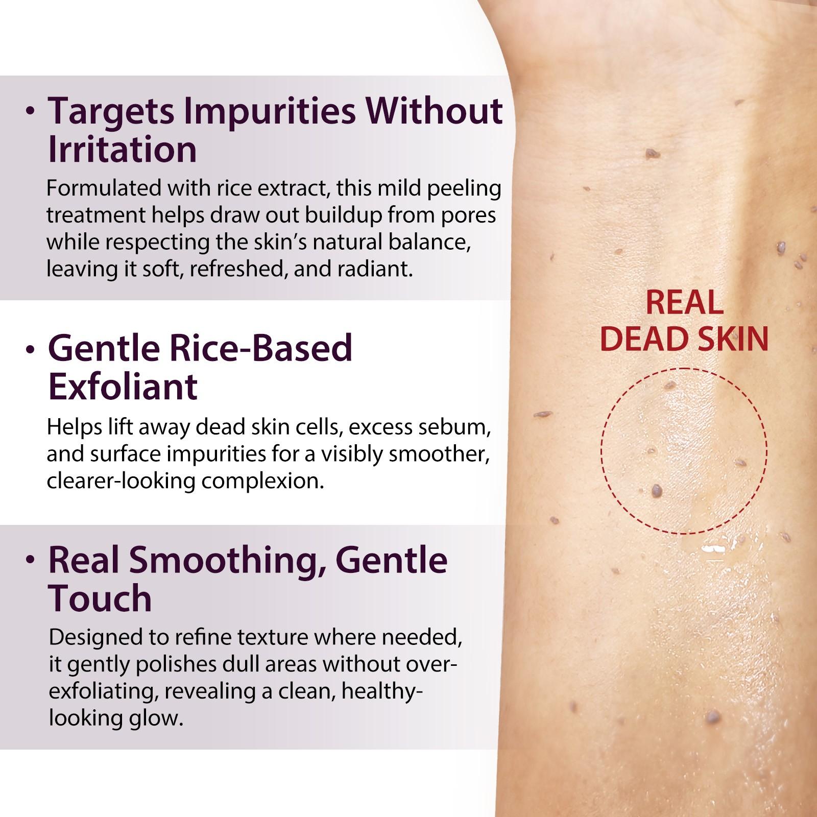 ikzee Fermented Rice Exfoliating Essence: A rice-based exfoliating formula designed to brighten and hydrate the skin. This gentle exfoliator is suitable for all skin types and helps reveal a healthy, radiant glow.