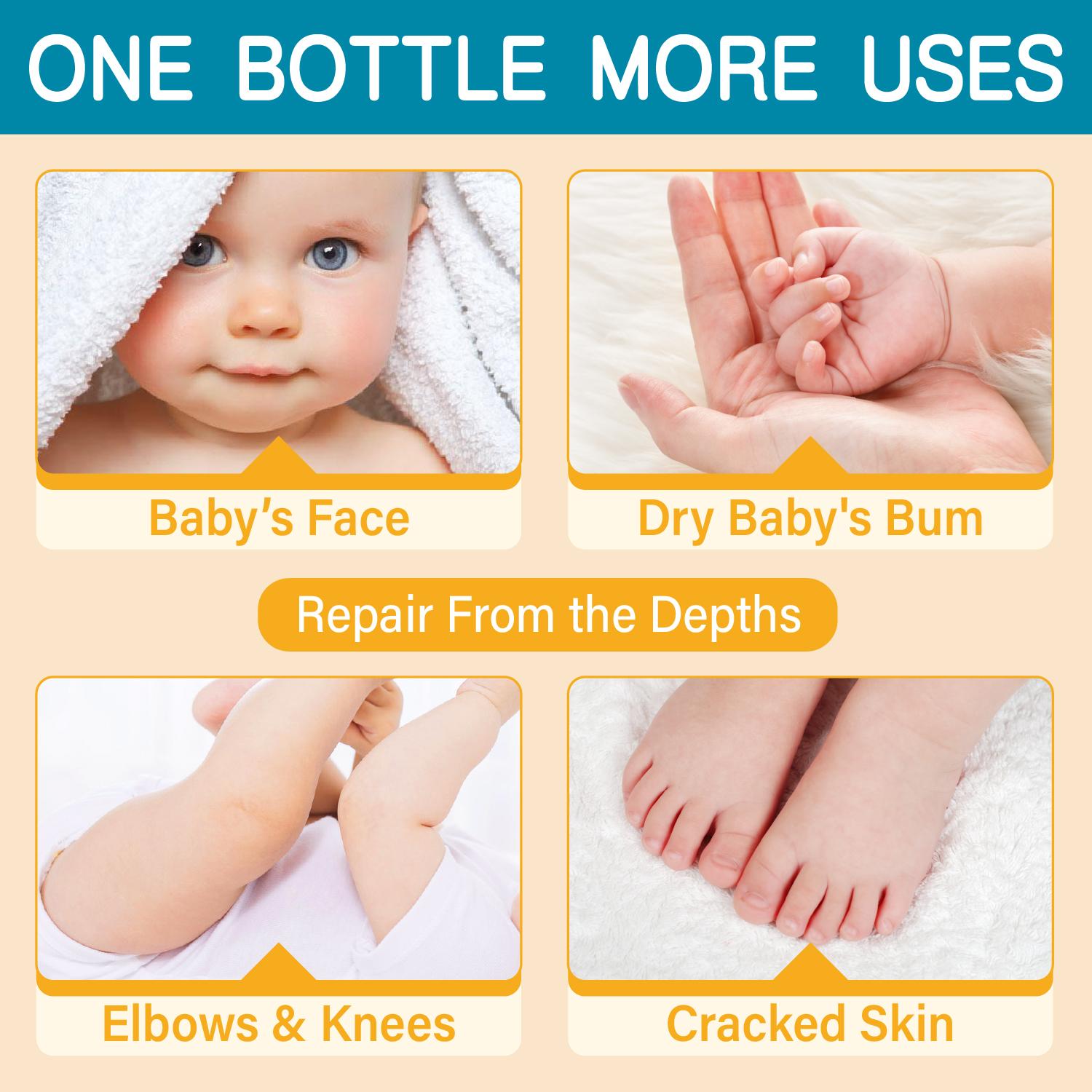 Body Butter for Kids - Prevents Cracked Skin Cream, Nourishing Moisturizing Kids Body Lotion - Shea Butter & Vitamin E Rich Formula, 3.53 Oz/100g