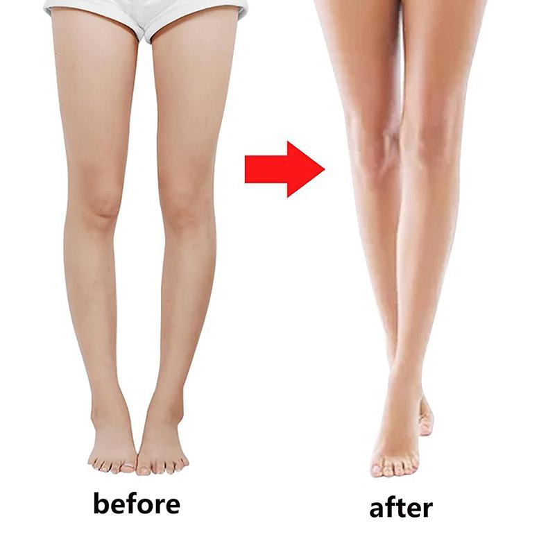 Leg Correction Belt 3 In 1 Leg Corrector Bandage O Or X Adjustable Leg Posture Correction Belt Bow Leg Corrector Inside Eight Character Corrector Leggings Belt Knock Knee Braces Leg Correction Belt 3 In 1 Leg Corrector Bandage O Or X Adjustable Leg Posture Correction Belt Bow Leg Corrector Inside Eight Character Corrector Leggings Belt Knock Knee Braces