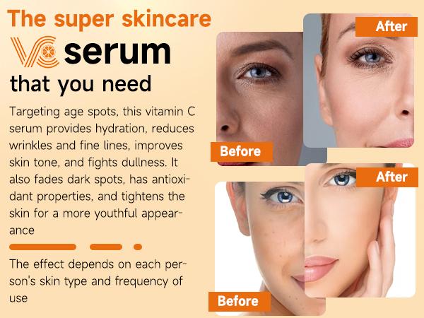 HANYWIL Vitamin C Gold | Anti-Aging Vitamin C Serum for Firming, Lifting & Hydrating Mature Skin | Dark Spot Correcting Serum for Skin Discoloration with Hyaluronic Acid | Suitable for all skin types cozyvibes effortlessbeauty fathersdaygifts