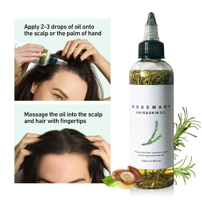 LANYAN 120ML Scalp Stimulating Hair Growth Oil, Light Mint & Peppermint Blend, Promotes Fuller Thicker Hair, Supports Hair Loss Repair