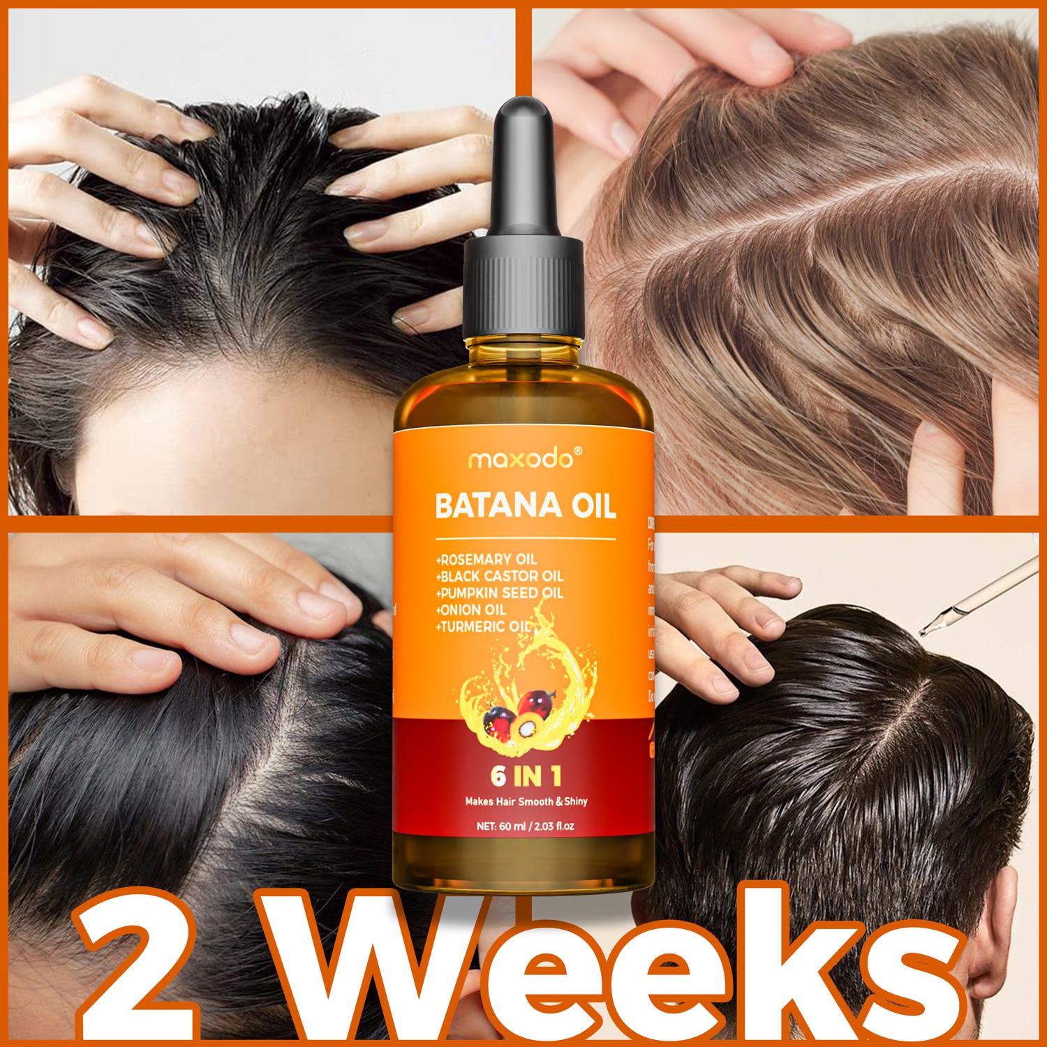 Maxodo Six in One Long Essential Oil - 100% Pure Rosemary Castor Pumpkin Seed & Batana Oils for Scalp Hair Health Moisturizing Vegan Organic Haircare Plant Conditioner Daily Jojoba Repair Moisture Cleansing Storage Turmeric Repairing Christmas Gifts Nouri