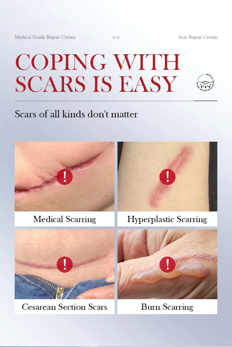 Scar Repair Gel - A lightweight formula for face and body that effectively fades acne scars and stretch marks