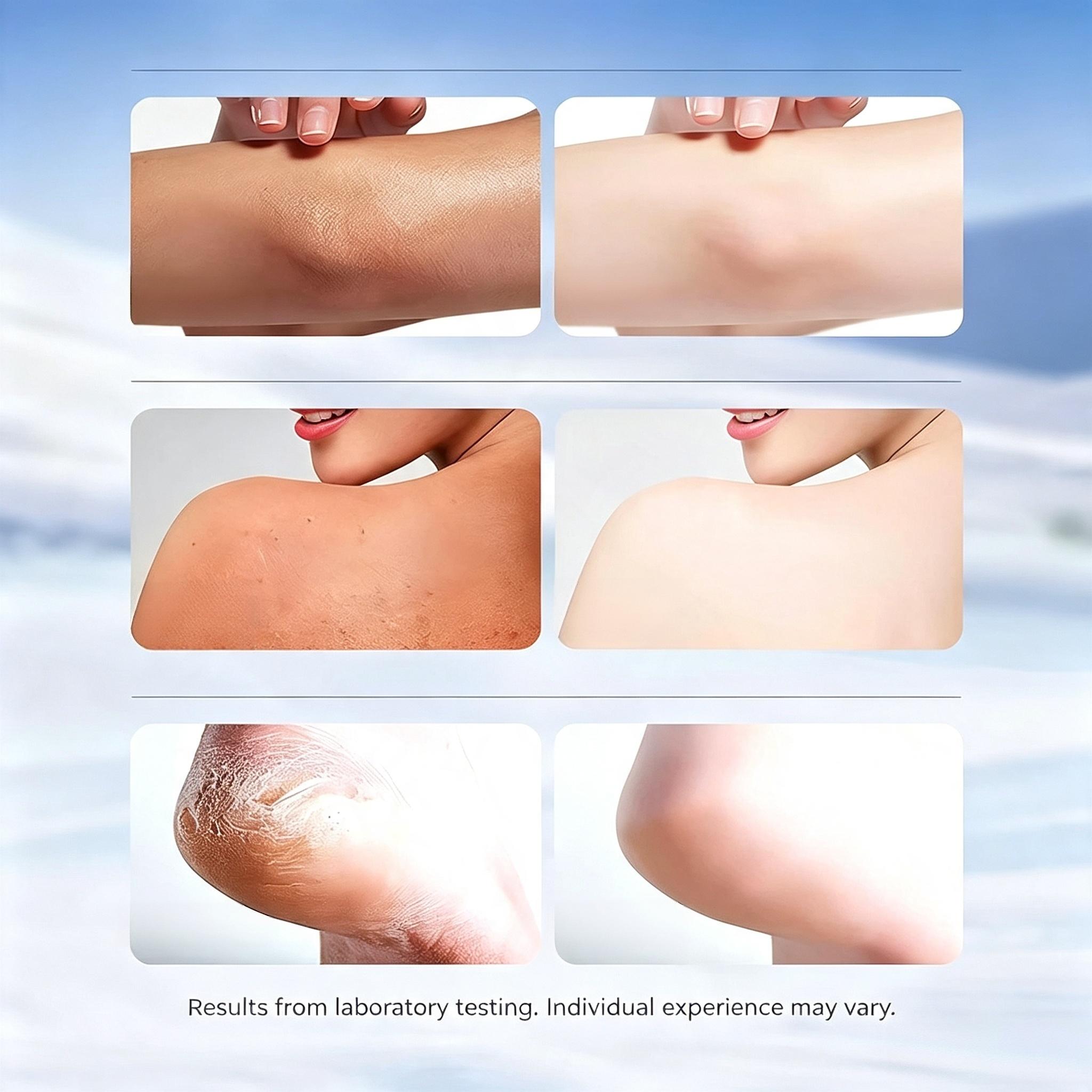 BEEVENOM Foot Cream, Bee Venom Dry Cracked Heel Cream for Dry Feet, Intensive Moisturizing & Exfoliating Foot Care, Softens Calluses & Rough Skin, Deep Hydration Repair for Cracked Heels, Essential Pedicure Treatment for Baby Soft Feet. #Skincare #FootCar
