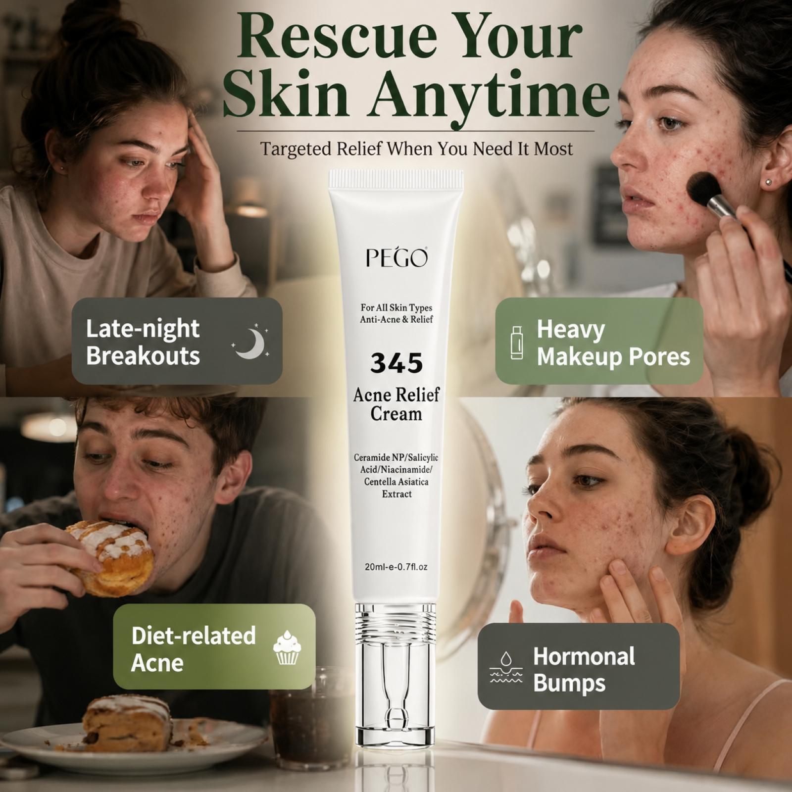 PEGO 345 Acne Relief Cream - Acne Solution Cream, Daily Face Moisturizer, Blemish Relief Care, Soothing Recovery, For Acne and Post-Acne Face Moisturizer with Centella,Salicylic Acid, Niacinamid,Calm Redness & Fade Acne Scars,Nighttime Acne Repair