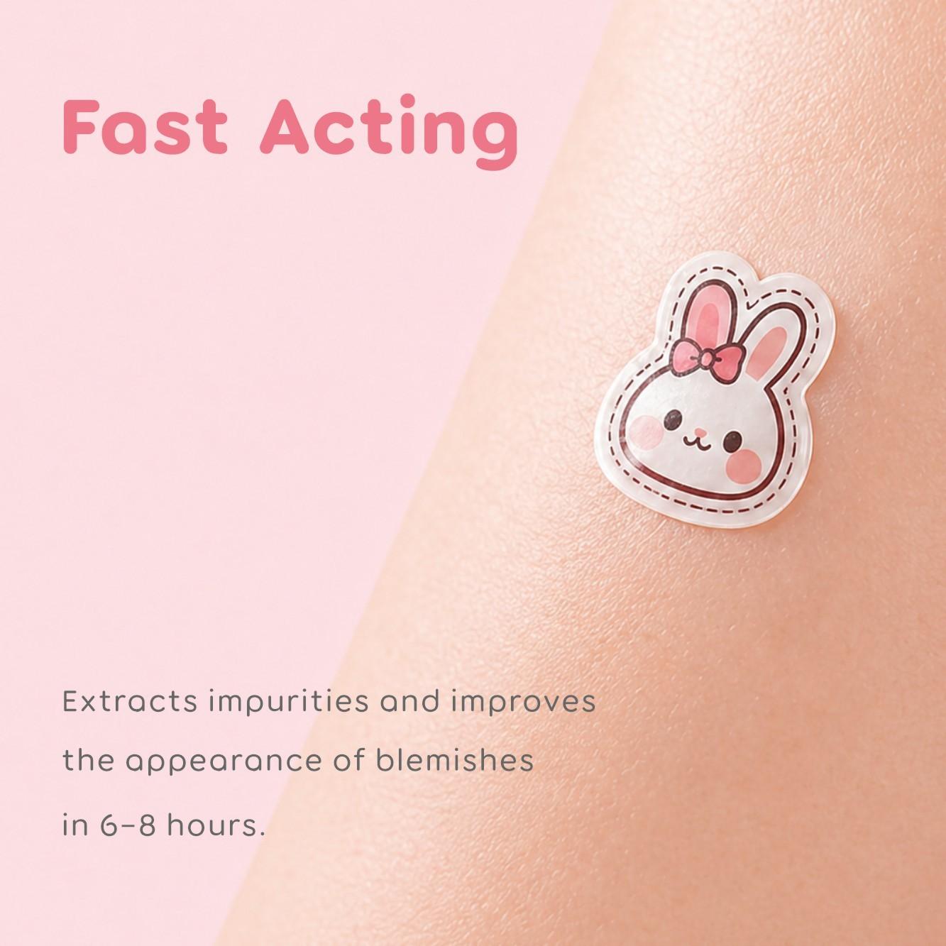 Rabbit-Shaped Acne Patches, Non-Irritating, Breathable, Makeup Covering, Alcohol-Free, Odorless, Daily Facial Care, 48/120/240 Pieces