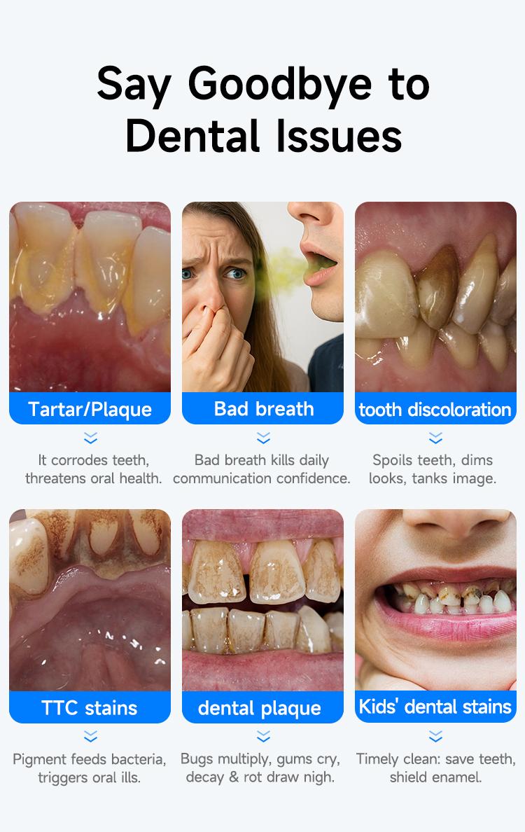 MDLIKE Plaque/Tartar Remover for Teeth, Dental Calculus Remover Teeth Cleaning Kit with LED Light & 5 Adjustable Modes Tartar Remover-Cleansing Mouth Care Father's Day Gift Long Battery Life Waterproof Oral