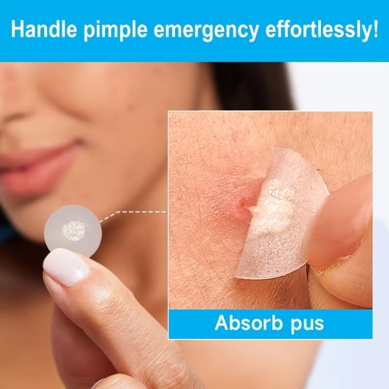 288pcs High-Quality Water Gel Patch, Concealer Patches & Covers, Gentle Non-Irritating, Waterproof Breathable, Essential Facial Skincare Product