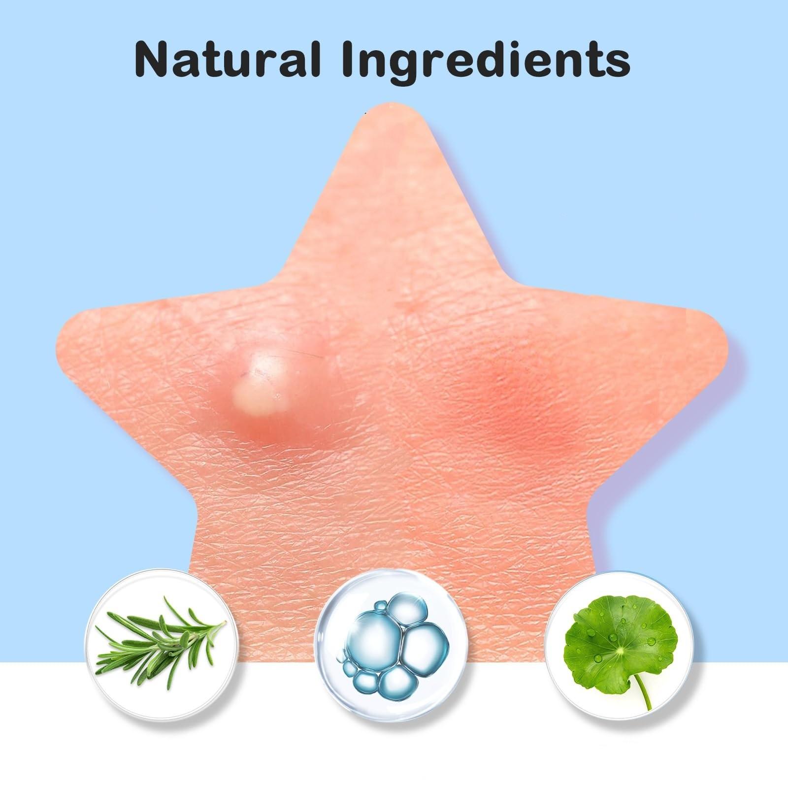 288pcs High-Quality Water Gel Patch, Concealer Patches & Covers, Gentle Non-Irritating, Waterproof Breathable, Essential Facial Skincare Product