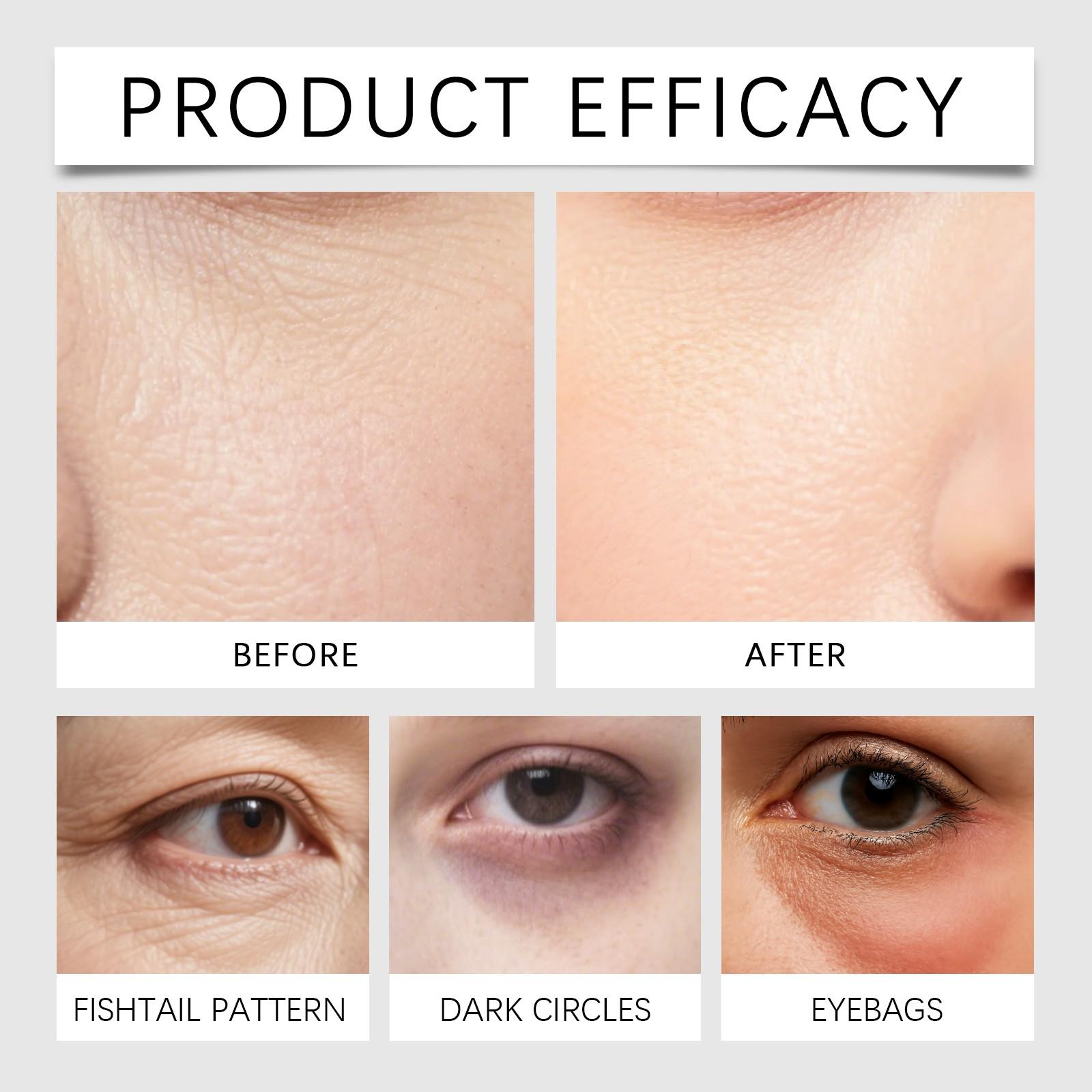 Revitalizing Rollerball Essence, Eye & Face Oil, Elasticity Boost, Brightening, Hydrating, Moisturizing, Radiant Skin Care