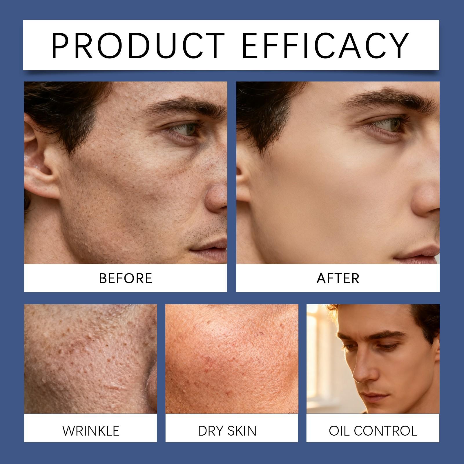 East Moon Men's Moisturizing Cream, Hydrating Smoothening Rich Nourishing Care, Moisture Retention Skin Care Cream for Men