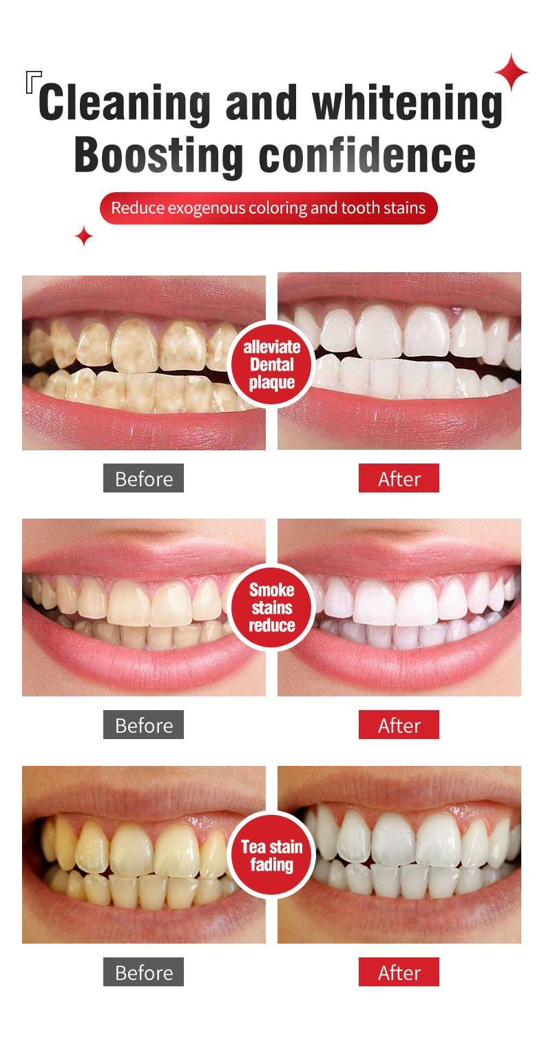 SP-4 probiotic toothpaste SP4 toothpaste fresh breath deep cleaning care toothpaste more effective than SP6/SP8/SP10 and SP-6/SP-8/SP-10 SP-4 probiotic toothpaste SP4 toothpaste fresh breath deep cleaning care toothpaste more effective than SP6/SP8/SP10 and SP-6/SP-8/SP-10