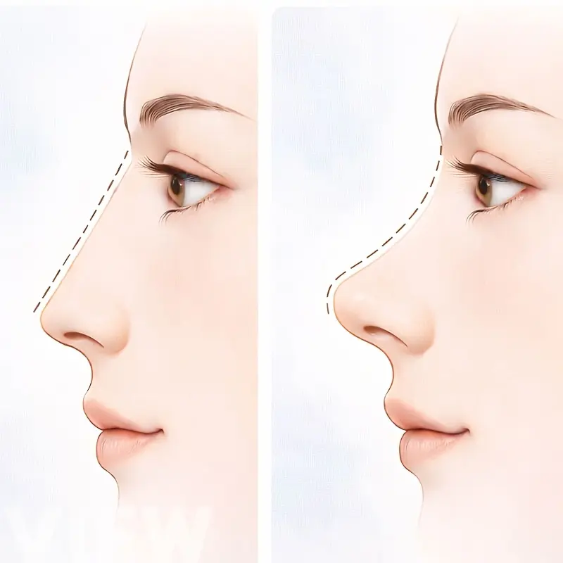2PCS/Sleep Memory Nose Bridge Height Increasing Trainer - Facial Nose Bridge Trainer - Nose Training Tool - Improve Nose Bridge - Elasticity; Suitable for Various Nose Types - Unisex - Not Easy To Slip - Day and Night - Lazy - Daily Beauty Tool