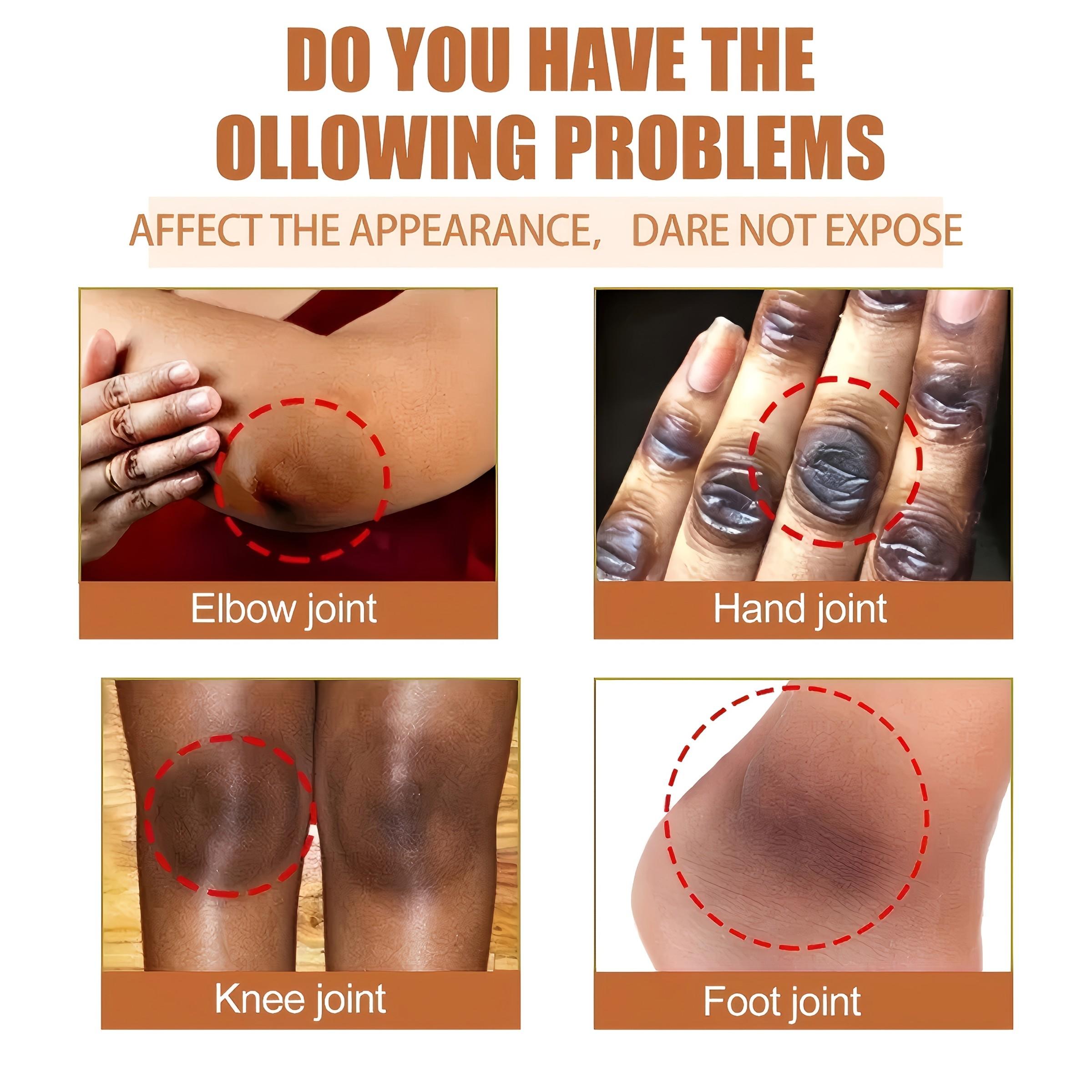 50g Vitamin C Cream, 3-Day Care, 2-Minute Absorption, Moisturizing Lotion for Underarms, Knees, Bikini Line, Neck, Collagen, Hyaluronic Acid, Niacinamide