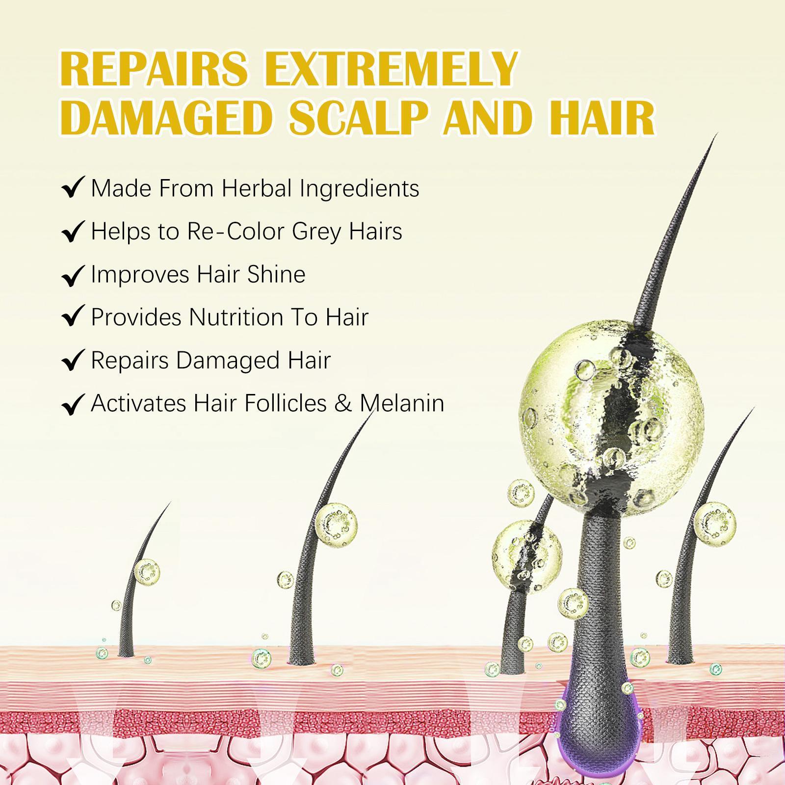 Hair Growth Oil for Men and Women - Regrowth Serum, Extra Strength Spray for Hair Loss, Thicker Healthier Hair, Beard Growth Kit, Topical Treatment, 2.02 oz