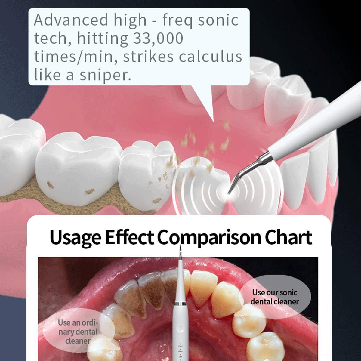 Plaque Remover for Teeth,Tartar Remover for Teeth Cleaning with 3 Replaceable Heads and 5 Adjustable Modes, Rechargeable Teeth Cleaning Plaque Remover for Home