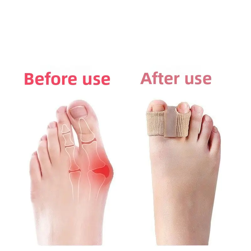 Gel Bunion Correctors with 2-Loops - Men's & Women's Toe Separators for Overlapping, Hammer Toes (4 Pack)