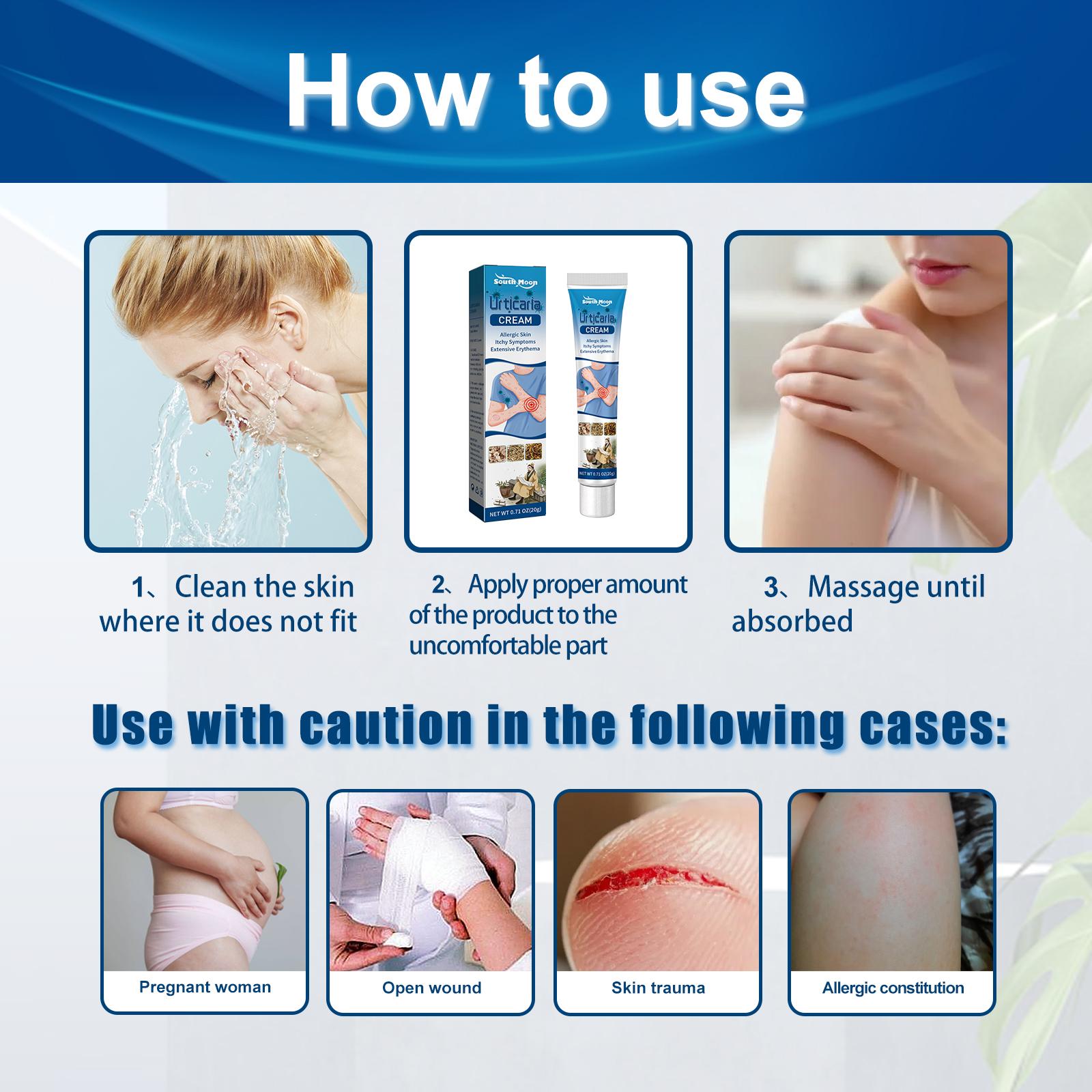 South Moon Urticaria Cream, Topical Ointment For Relieving Pruritus Redness And Repairing Skin