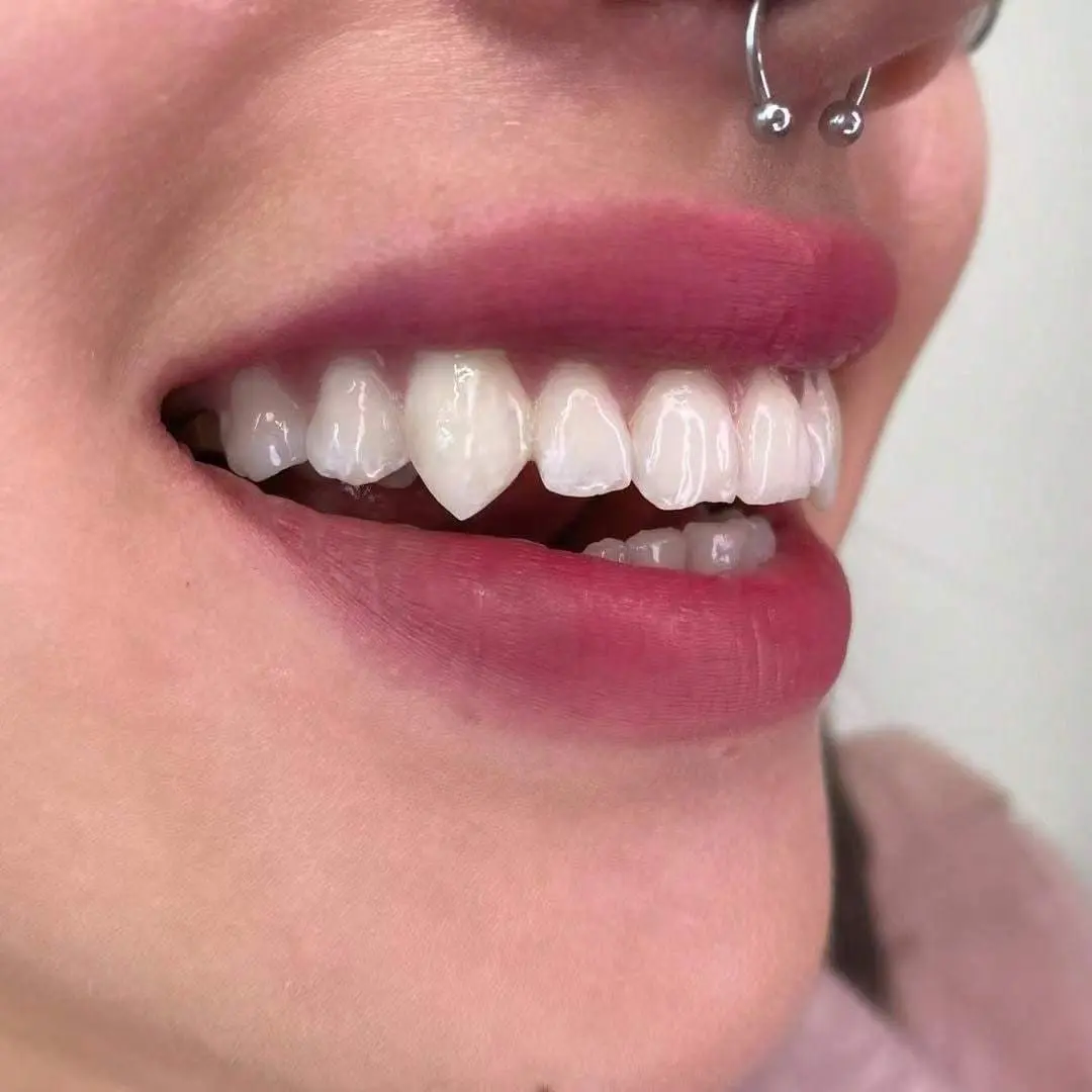 2pcs/ SET Vampire Teeth Fangs Werewolf Teeth Cosplay Prop Decoration for Halloween Party Costume Accessory
