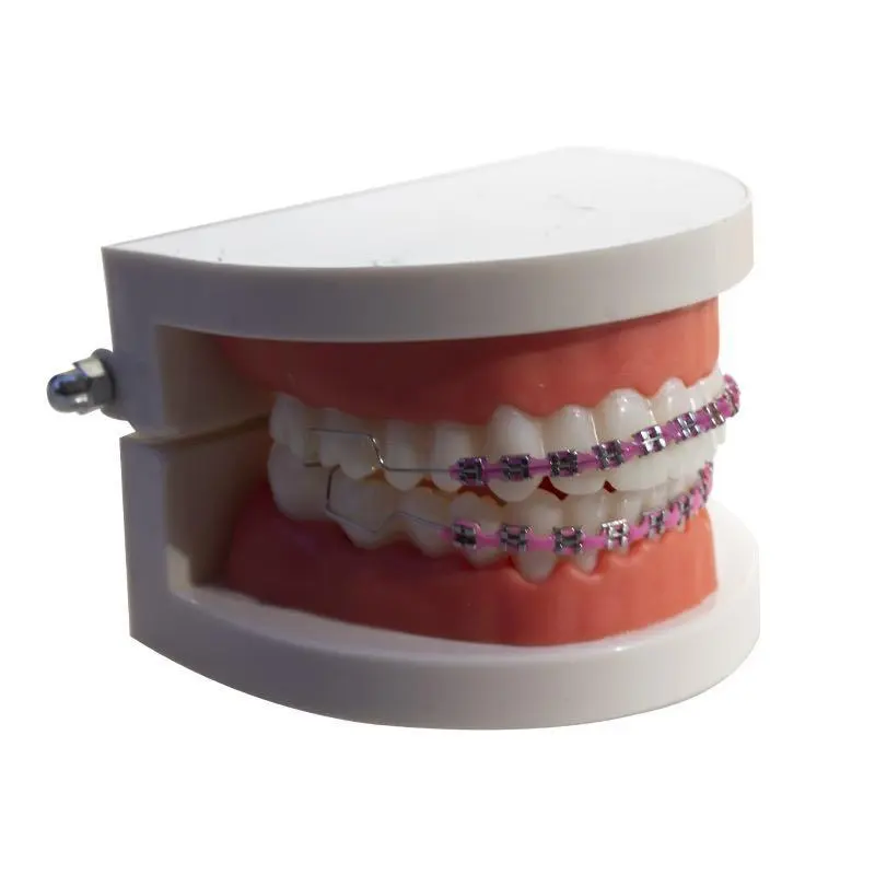 Colorful Zipper Teeth Accessory, 2-Piece Novelty Plastic Fake Braces for Upper and Lower Jaw, Costume Party Mouth Jewelry