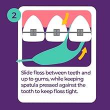Orthodontic Flossers for Braces, 30 Count (Pack of 2), Ortho Picks for Adults & Kids, Fits Under Arch Wire, Non-Damaging, Encourage Flossing Habits