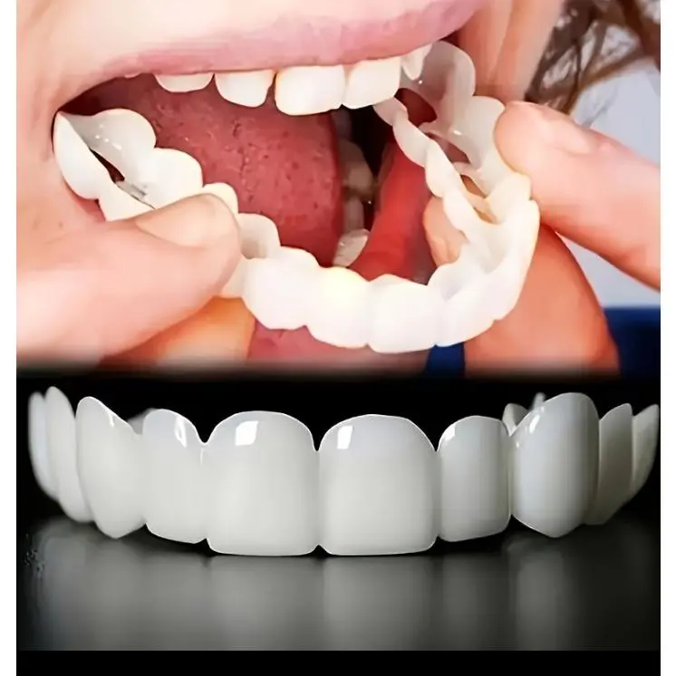 Comfortable 4-piece dental aligner set, non-porous aligners for teeth whitening, gap filling, temporary dentures, white veneer aligners, suitable for both men and women, night-time mouthguard aligners Masks Gifts