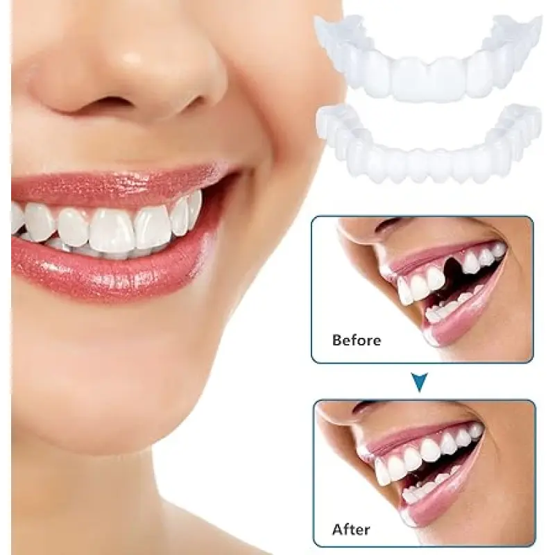 2-Pair Oral Instant Veneers, Snap-On Smile Fake Teeth, Cosmetic Whitening Tooth Covers, Clip-In Top and Bottom Dentures confident portable Dental