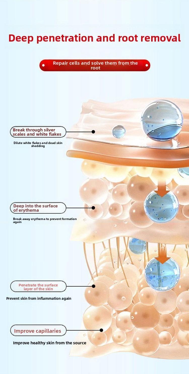 Premium All-Natural Herbal Soothing Cream for Psoriasis Eczema Dry Sensitive Skin Relief Plant-Based Itch Treatment Balm for Mosquito Bites 30g Hypoallergenic Skin Lotion